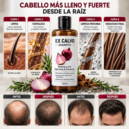 💪 Shampoo EX CALVO 300 ml para el Cuidado Capilar + Regalo 🎁 | Envío Gratis 🚚